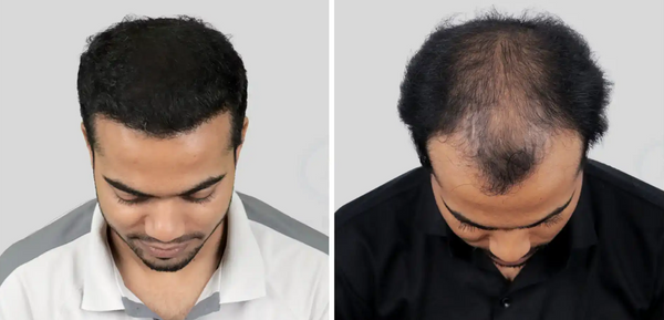 Review product image