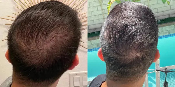 Review product image