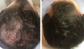 Review product image