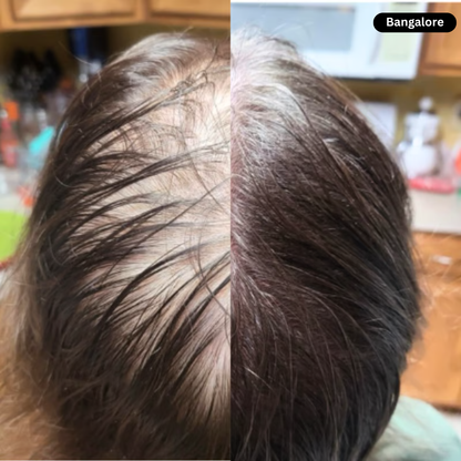 Hair Regrowth Red Light Therapy Hat