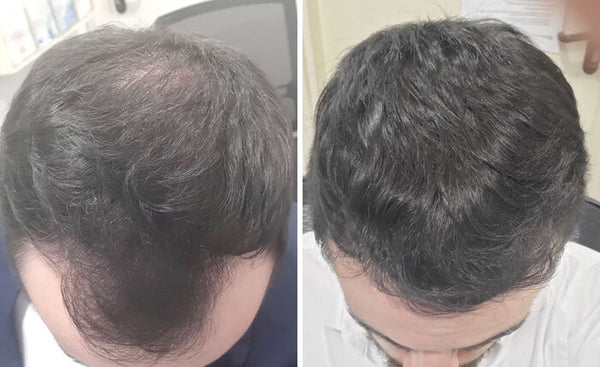 Review product image