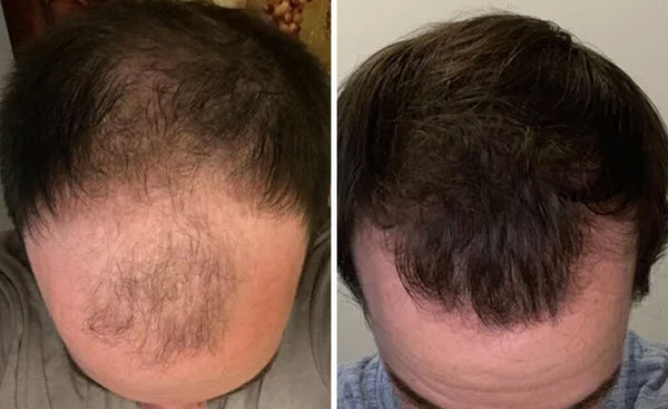 Review product image